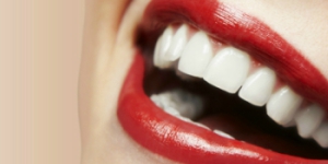 Dental Insurance Santa Rosa